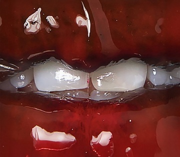 CROPPED